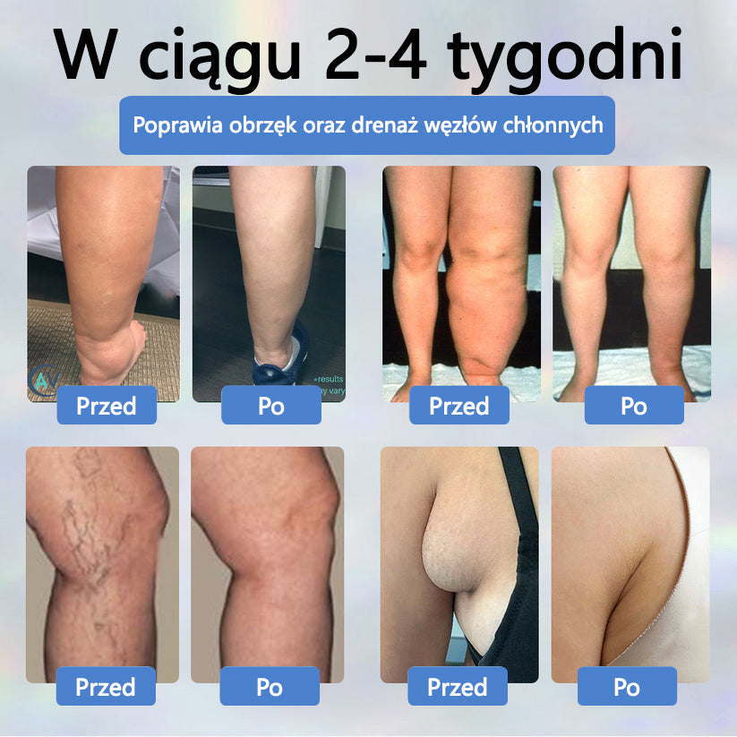 Final 3 Hours: 60%OFF🔥Knee Pain from Arthritis? STOP Suffering!