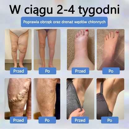 Final 3 Hours: 60%OFF🔥Knee Pain from Arthritis? STOP Suffering!