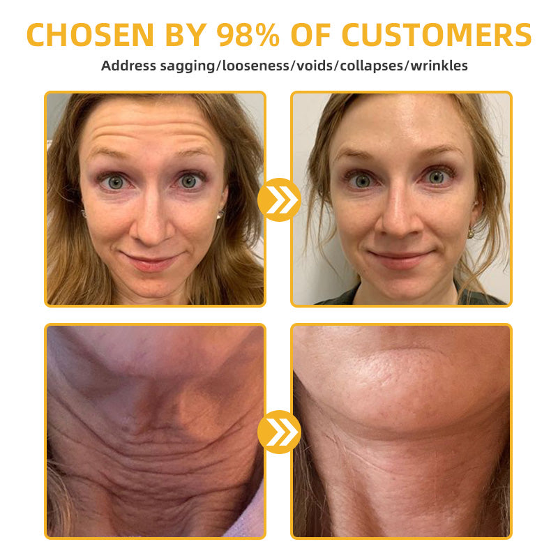 💐💞Lovilds™ BeeLift Anti-Aging Firming Cream,Address Crepe & Sagging(🔥74% Off for a Limited Time!)