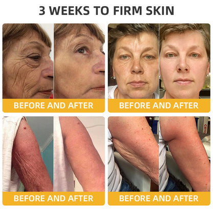 💐💞Lovilds™ BeeLift Anti-Aging Firming Cream,Address Crepe & Sagging(🔥74% Off for a Limited Time!)