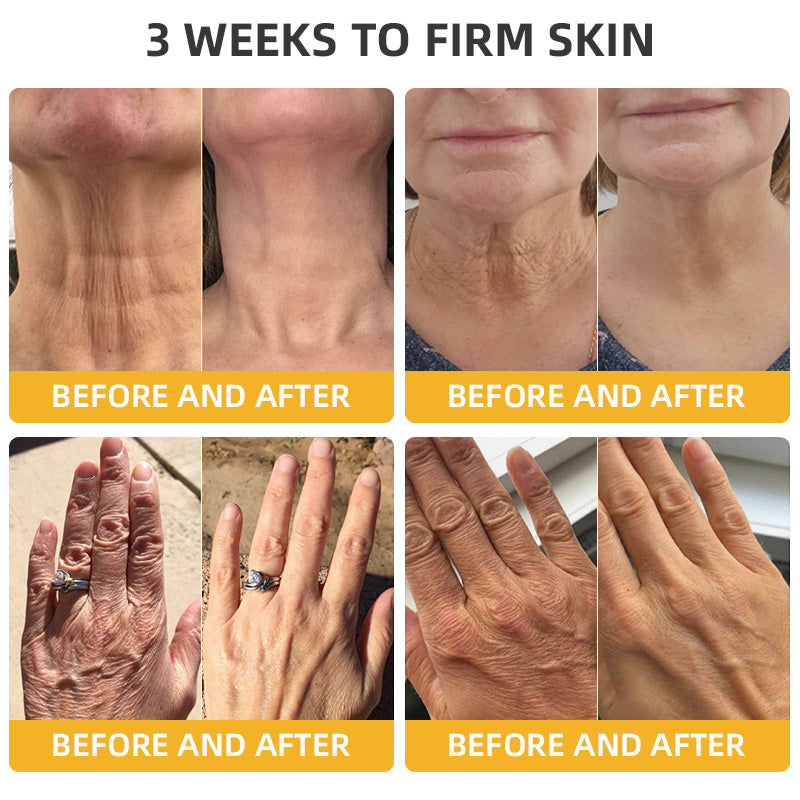 💐💞Lovilds™ BeeLift Anti-Aging Firming Cream,Address Crepe & Sagging(🔥74% Off for a Limited Time!)