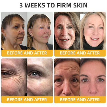 💐💞Lovilds™ BeeLift Anti-Aging Firming Cream,Address Crepe & Sagging(🔥74% Off for a Limited Time!)