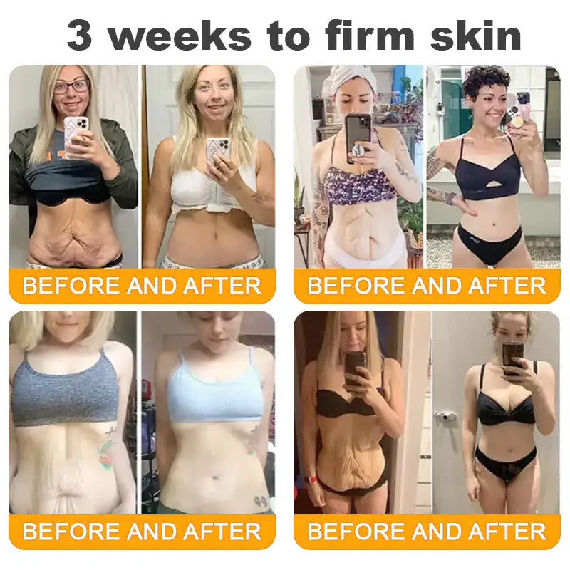 Made and Shipped from USA ✨ Cheemex® Bee Toxin Skin Restoration Cream ⏰ LAST DAY 80% OFF✨✨