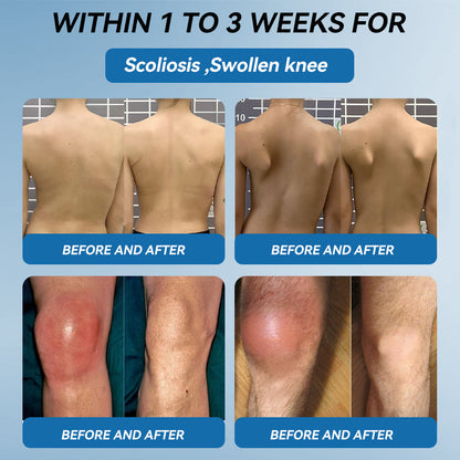 𝐅𝐃𝐀 𝐀𝐩𝐩𝐫𝐨𝐯𝐞𝐝👩‍⚕️|LOVILDS® 𝑩𝐏𝐂-𝟏𝟓𝟕 𝐉𝐨𝐢𝐧𝐭 𝐇𝐞𝐚𝐥𝐢𝐧𝐠 𝐂𝐫𝐞𝐚𝐦🦴 Relief for Arthritis, Neuropathy, Rheumatism & Sports Injuries & 𝐌𝐨𝐫𝐞