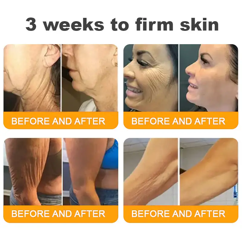 Made and Shipped from USA ✨ Cheemex® Bee Toxin Skin Restoration Cream ⏰ LAST DAY 80% OFF✨✨