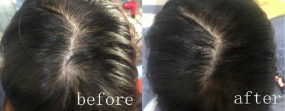 Lovilds® Hair Restoration Spray ( Reawaken Your Roots. Regrow Naturally. ✨ Clinically Proven Hair Regrowth Within 4 Weeks ✨)