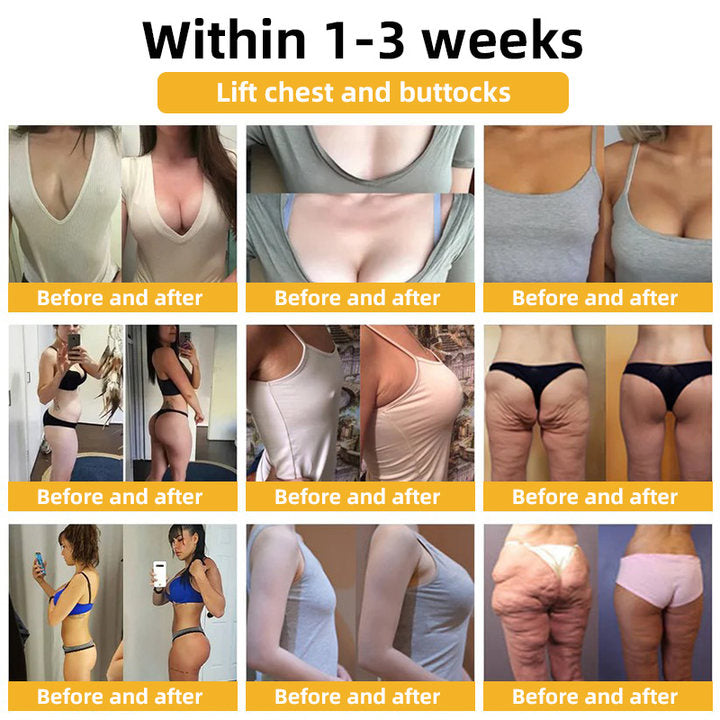 💐💞Lovilds™ BeeLift Anti-Aging Firming Cream,Address Crepe & Sagging(🔥74% Off for a Limited Time!)